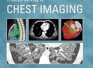 free-pdf-download-Problem Solving in Chest Imaging 1st Edition