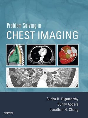 free-pdf-download-Problem Solving in Chest Imaging 1st Edition