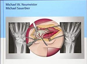 free-pdf-download-Problems in Hand Surgery: Solutions to Recover Function