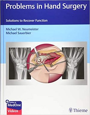 free-pdf-download-Problems in Hand Surgery: Solutions to Recover Function