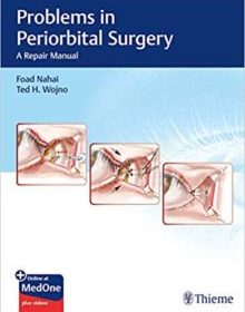 free-pdf-download-Problems in Periorbital Surgery: A Repair Manual 1st Edition