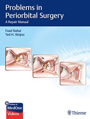 free-pdf-download-Problems in Periorbital Surgery: A Repair Manual