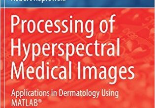 free-pdf-download-Processing of Hyperspectral Medical Images: Applications in Dermatology Using Matlab® (Studies in Computational Intelligence) 2017 ed. Edition