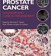 free-pdf-download-Prostate Cancer: Diagnosis and Clinical Management 1st Edition