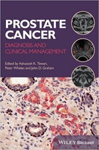 free-pdf-download-Prostate Cancer: Diagnosis and Clinical Management 1st Edition