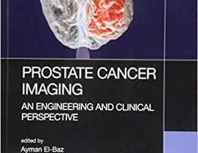 free-pdf-download-Prostate Cancer Imaging: An Engineering and Clinical Perspective