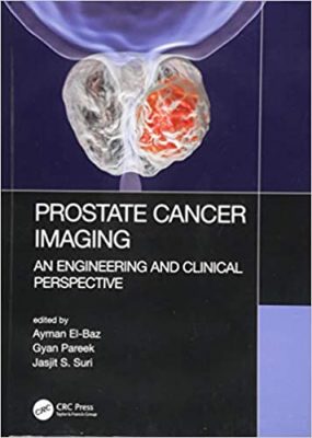 free-pdf-download-Prostate Cancer Imaging: An Engineering and Clinical Perspective