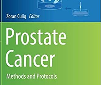 free-pdf-download-Prostate Cancer: Methods and Protocols (Methods in Molecular Biology) 1st ed