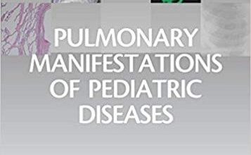 free-pdf-download-Pulmonary Manifestations of Pediatric Diseases E-Book