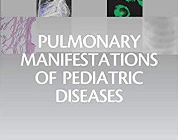 free-pdf-download-Pulmonary Manifestations of Pediatric Diseases E-Book