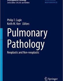 free-pdf-download-Pulmonary Pathology: Neoplastic and Non-Neoplastic (Encyclopedia of Pathology)