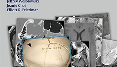 free-pdf-download-RadCases Head and Neck Imaging 1 Pap/Psc Edition