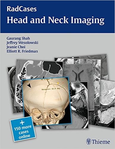 free-pdf-download-RadCases Head and Neck Imaging 1 Pap/Psc Edition