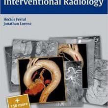 free-pdf-download-Radcases Interventional Radiology