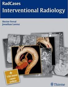 free-pdf-download-Radcases Interventional Radiology