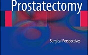 free-pdf-download-Radical Prostatectomy: Surgical Perspectives