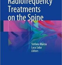 free-pdf-download-Radiofrequency Treatments on the Spine 1st ed. 2017 Edition