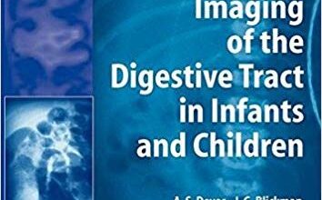 free-pdf-download-Radiological Imaging of the Digestive Tract in Infants and Children (Medical Radiology)