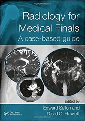 free-pdf-download-Radiology for Medical Finals: A case-based guide