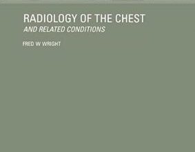 free-pdf-download-Radiology of the Chest and Related Conditions