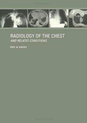 free-pdf-download-Radiology of the Chest and Related Conditions