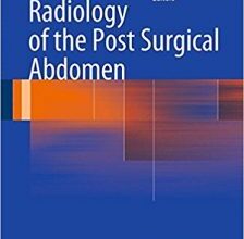 free-pdf-download-Radiology of the Post Surgical Abdomen