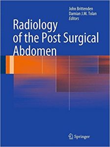 free-pdf-download-Radiology of the Post Surgical Abdomen