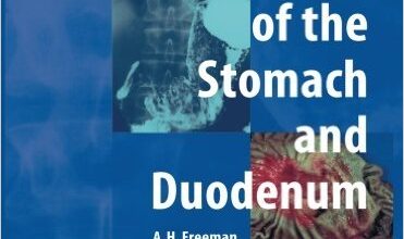 free-pdf-download-Radiology of the Stomach and Duodenum