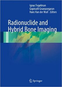 free-pdf-download-Radionuclide and Hybrid Bone Imaging