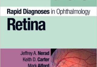 free-pdf-download-Rapid Diagnosis in Ophthalmology Series: Retina