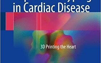 free-pdf-download-Rapid Prototyping in Cardiac Disease: 3D Printing the Heart 1st ed. 2017 Edition