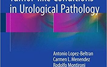 free-pdf-download-Rare Tumors and Tumor-like Conditions in Urological Pathology