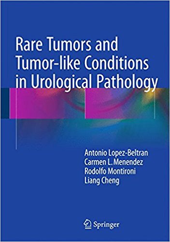 free-pdf-download-Rare Tumors and Tumor-like Conditions in Urological Pathology