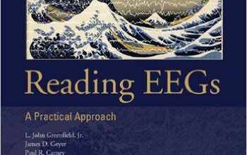 free-pdf-download-Reading EEGs: A Practical Approach