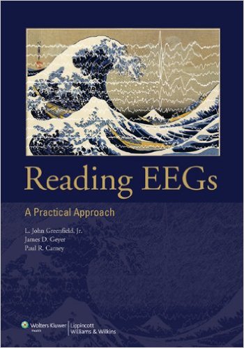 free-pdf-download-Reading EEGs: A Practical Approach