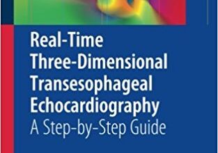 free-pdf-download-Real-Time Three-Dimensional Transesophageal Echocardiography: A Step-by-Step Guide 2012th Edition