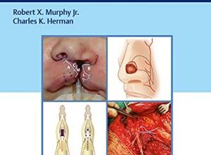 free-pdf-download-Reconstructive Plastic Surgery: An Atlas of Essential Procedures