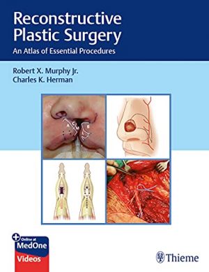 free-pdf-download-Reconstructive Plastic Surgery: An Atlas of Essential Procedures