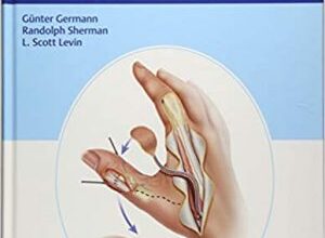 free-pdf-download-Reconstructive Surgery of the Hand and Upper Extremity Illustrated Edition