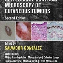 free-pdf-download-Reflectance Confocal Microscopy of Cutaneous Tumors 2nd Edition