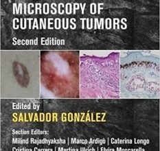 free-pdf-download-Reflectance Confocal Microscopy of Cutaneous Tumors