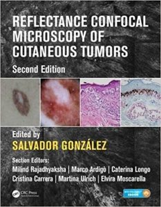 free-pdf-download-Reflectance Confocal Microscopy of Cutaneous Tumors