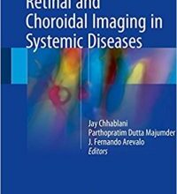 free-pdf-download-Retinal and Choroidal Imaging in Systemic Diseases 1st ed. 2018 Edition