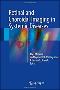 free-pdf-download-Retinal and Choroidal Imaging in Systemic Diseases 1st ed. 2018 Edition