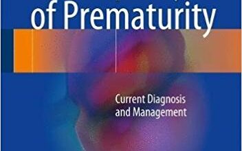 free-pdf-download-Retinopathy of Prematurity: Current Diagnosis and Management 1st ed. 2017 Edition