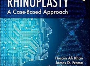 free-pdf-download-Rhinoplasty: a Case-based approach 1st Edition