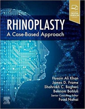 free-pdf-download-Rhinoplasty: a Case-based approach 1st Edition