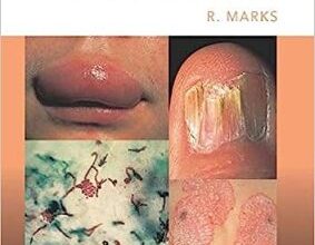 free-pdf-download-Roxburgh’s Common Skin Diseases 17th Edition