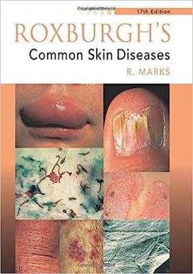 free-pdf-download-Roxburgh’s Common Skin Diseases 17th Edition