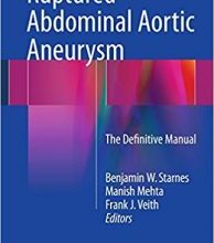 free-pdf-download-Ruptured Abdominal Aortic Aneurysm: The Definitive Manual 1st ed. 2017 Edition